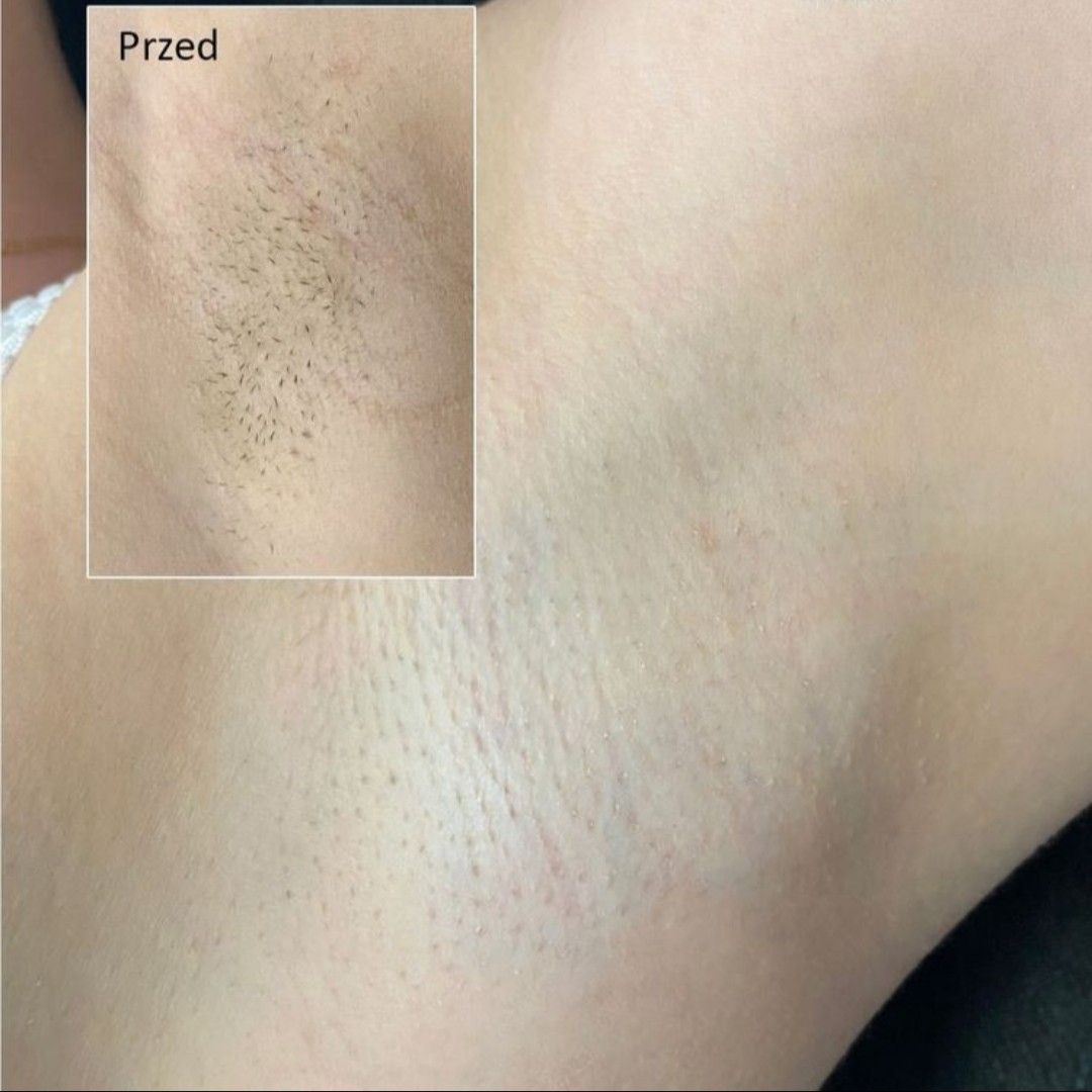 Wnętrze salonu Luna Laser