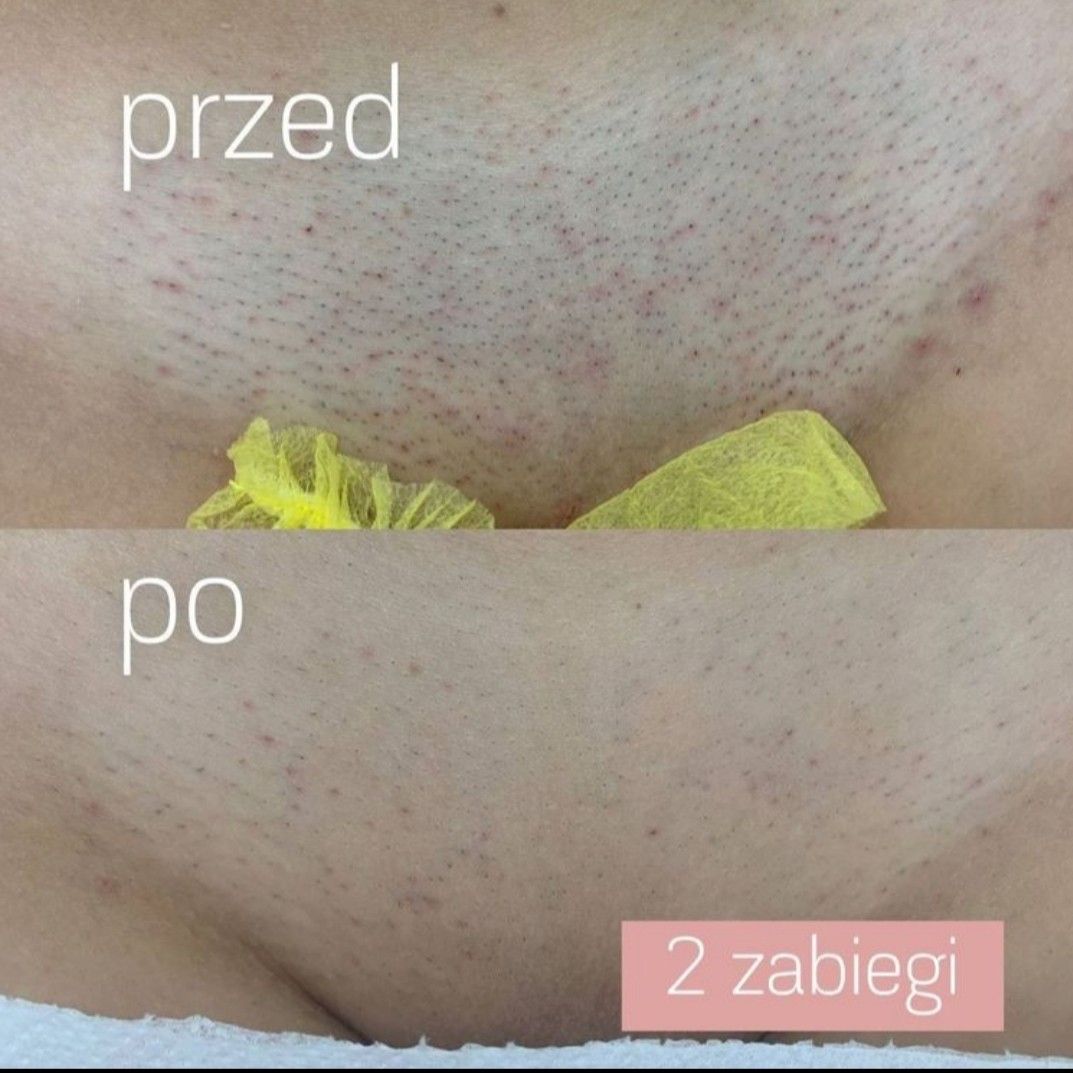 Wnętrze salonu Luna Laser